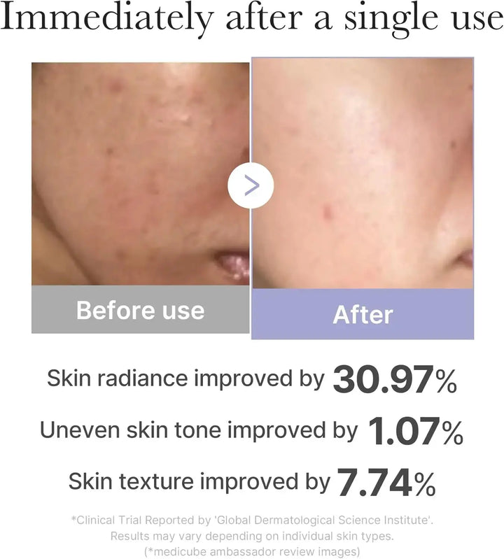 MEDICUBE AGE R Booster Pro Mini Medicube JOLIE'S