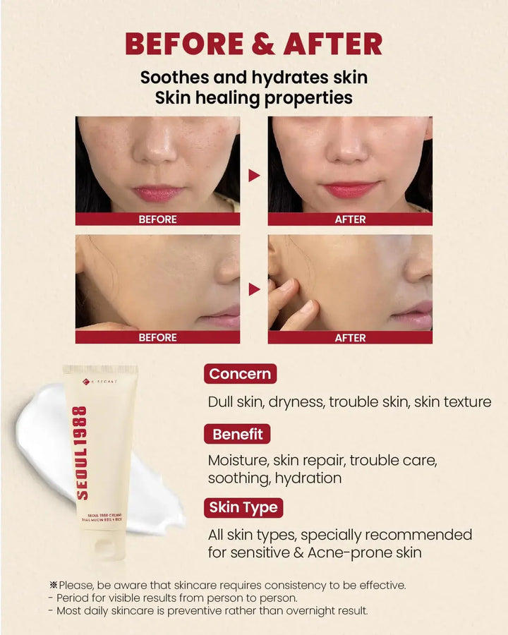 KSECRET SEOUL 1988 Cream: Snail Mucin 93% + Rice (100ml) KSECRET SEOUL 1988 JOLIE'S