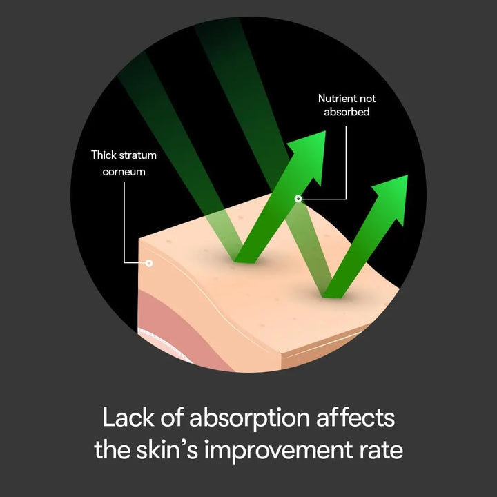 DOKAN VT REEDLE SHOT 100 VT REEDLE SHOT